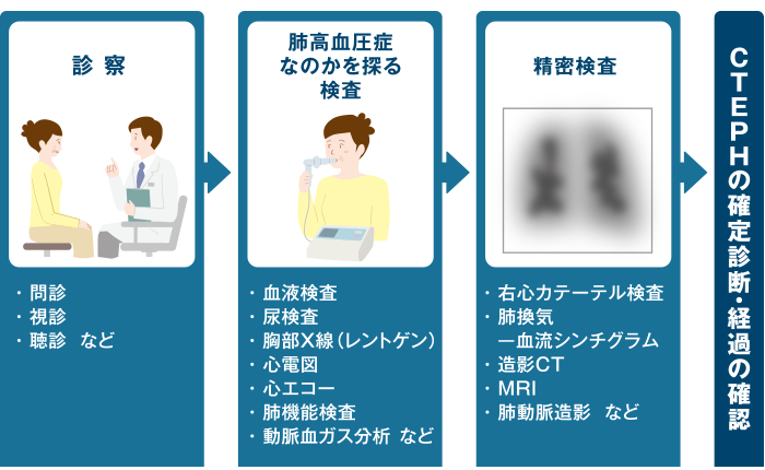 CTEPHと診断されるまでの検査