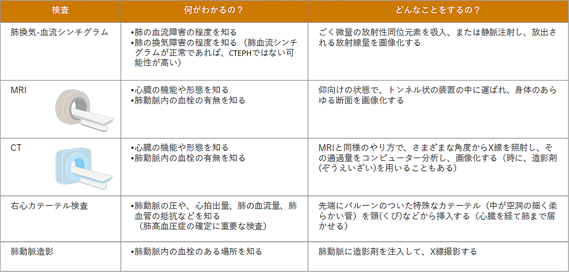 CTEPHと確定診断するために、さらに詳しい検査に進む